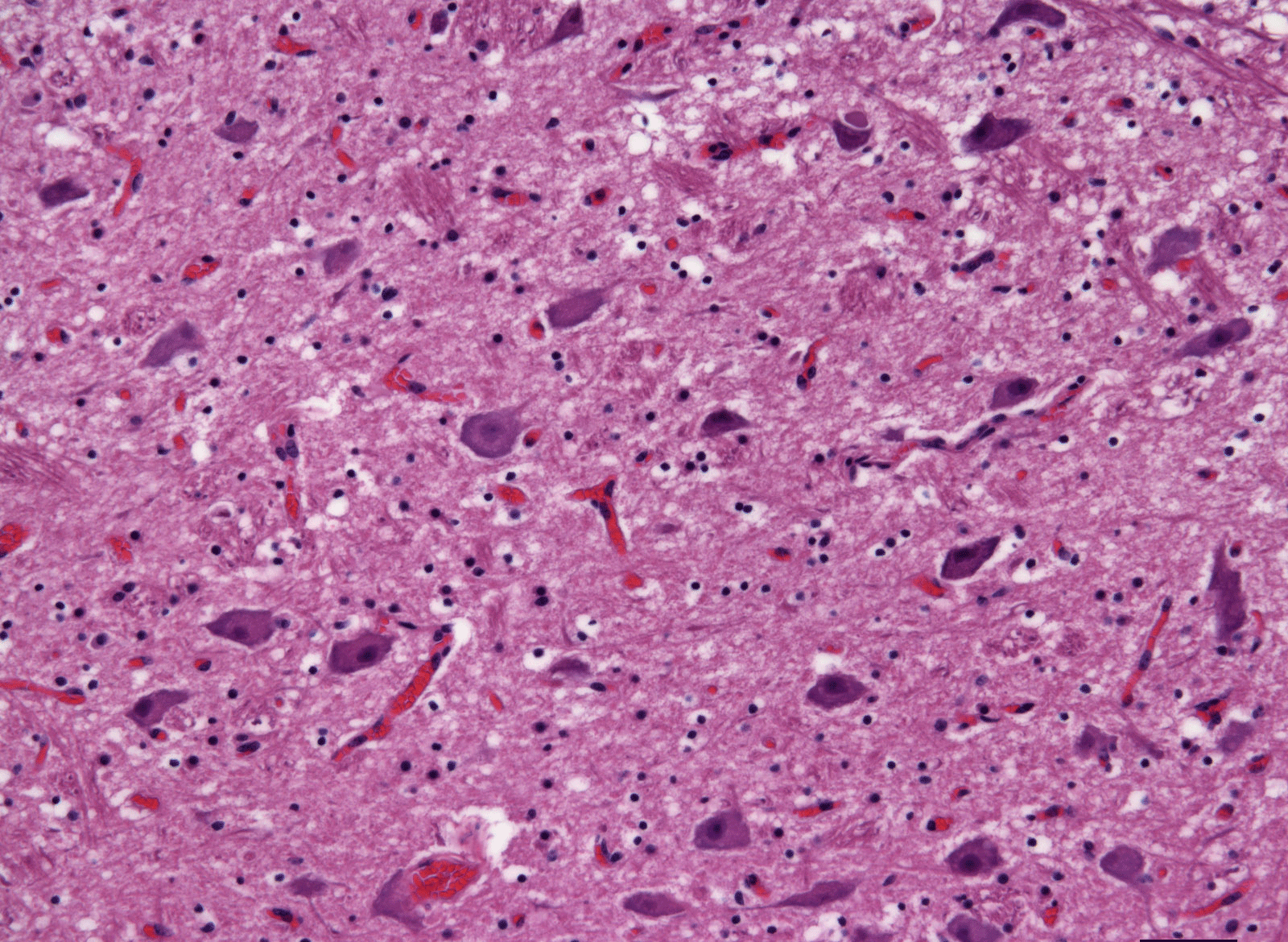دماغ بقرة سليمة ، كما يظهر تحت المجهر باستخدام بقع خاصة. حقوق الصورة للدكتورة كاتي كيلي ، جامعة جونز هوبكنز